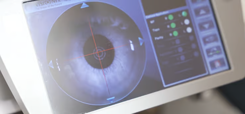 הטכנולוגיה שמשנה את עולם עדשות המגע