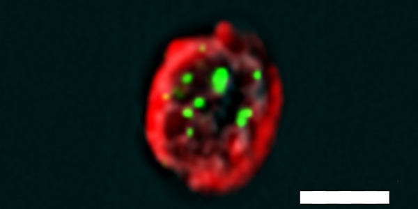 Cellular “selfie”: an mTEC cell viewed by means of the new method, called PLIC. The green dots reveal a protein interaction that helps prevent an autoimmune attack. scalebar: 7 µm