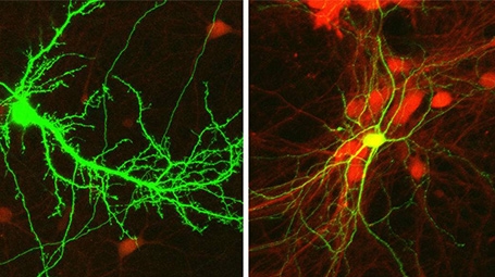 Mouse neurons – excitatory (left) and inhibitory – viewed under a microscope