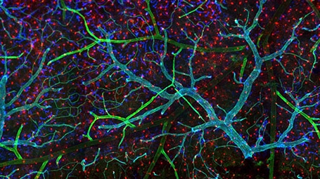 Meninges and underlying tissue in a mouse brain: Microglia (red) have a characteristic hairy structure. Blood vessels are in green