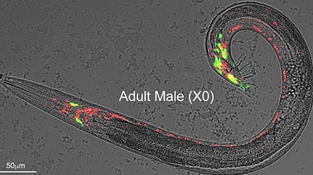 The nervous system of the worm under a microscope. The nuclei of neurons shared by both sexes are labeled in red; the neurons present in males only are marked in green