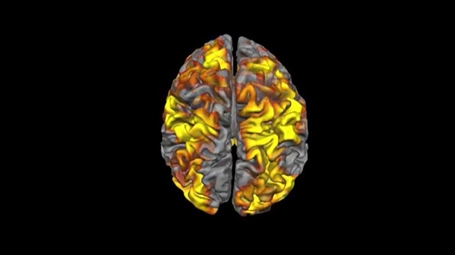 fMRI of a creative brain