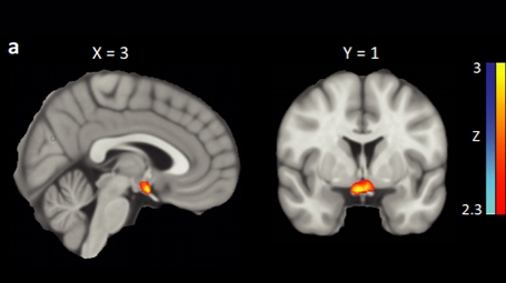 fMRI images showing the hypothalamus reactions to body odor