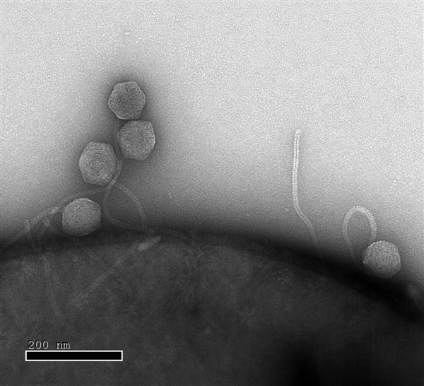 Close up: Phages infecting this E. coli in the lab of Prof. Rotem Sorek find bacterial defense systems in place