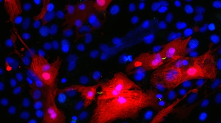 Cardiac culture. The cardiomyocytes are tagged red; green lines are cleavage furrows between dividing cells