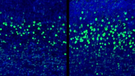 Cross sections of embryo cortex at day 18 of pregnancy (left), compared to an embryo from the maternal immune activation group (right). The green shows cells in the fifth layer of the brain (CTIP2+ neurons), which are overproduced in those of the immune response group. Scale bar: 20 micrometers