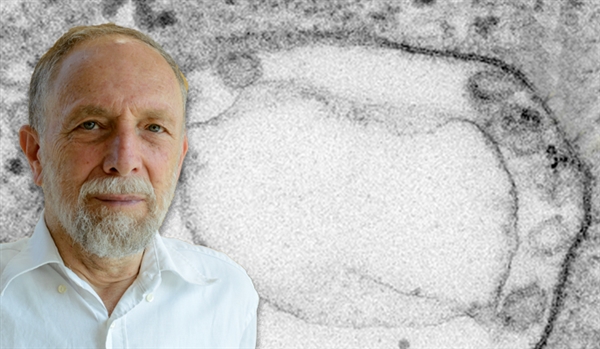 Prof. David Wallach. Proteins slated for destruction or removal from the cell are temporarily contained in small vesicles within a multivesicular body (the large circular structure in the center). Right: In the absence of the MLKL protein, this “housekeeping” function is disrupted, and the vesicles intended for carrying the proteins further fail to develop properly. Viewed under an electron microscope