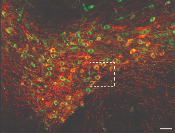 Lighting up the reward center: Light-sensitive (optogenetic) proteins are inserted into specific brain cells. Green: dopamine-producing cells in the reward system in the ventral tegmental area. Red: cells carrying the inserted protein in a mouse brain. Yellow: Overlap between cells that are carrying the optogenetic protein and those that are dopamine-producing. Image obtained by confocal microscope in the lab of Prof. Tali Kimchi